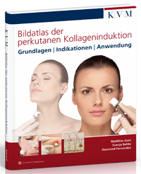 KVM BILDATLAS DER PERKUTANEN KOLLAGENINDUKTION - DR. AUST/DR. FERNANDES